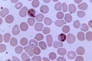 Plasmodium and malaria