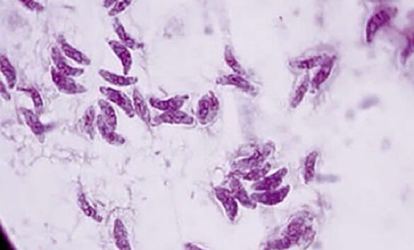 protozoan parasite toxoplasma gondii causative agent of toxoplasmosis
