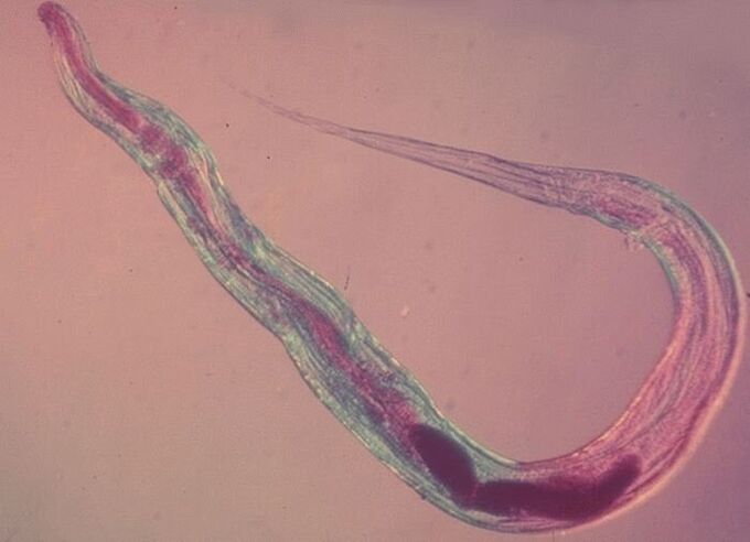 Penworm under the microscope