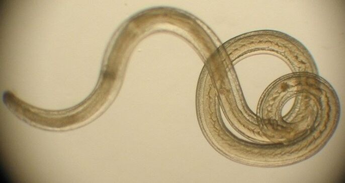 parasitic worms from the human body